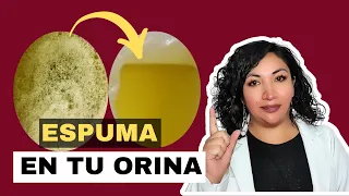 ELIMINA la espuma de tu orina (porque tu orina tiene espuma?) 😨