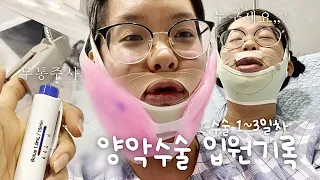 양악수술 당일부터 입원기록 : 생각보다 꽤나 멀쩡한 나