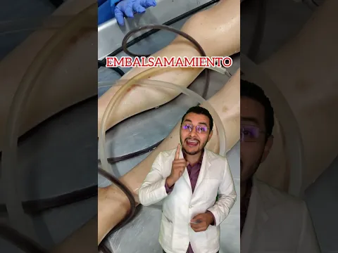 Así se extrae la SANGRE, ORINA Y HECES de un CADÁVER 😱💀⚠️  #shorts