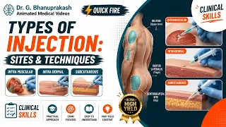 Types of injection: Sites  & Techniques - Intra muscular Intra dermal Subcutaneous | Clinical Skills