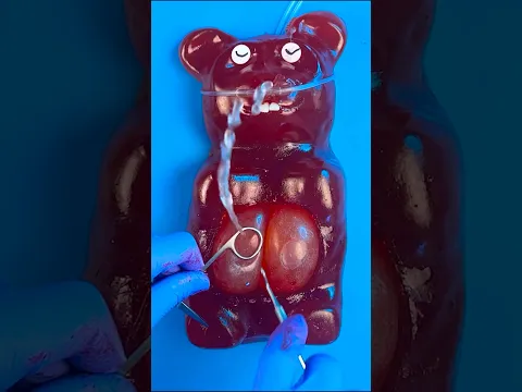 Will The World's Biggest Gummy Bear Survive a 36 Baby C-Section? 😭💔🤧🐻 #foodsurgery #satisfying #asmr