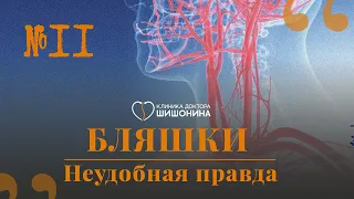 Бляшки и как с ними жить: рассказывает сосудистый хирург в новом выпуске «Хорошей медицины» 💊