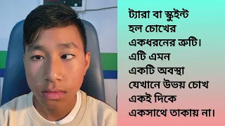 আপনি কি জানেন ট্যারা চোখের চিকিৎসা সম্ভব! Do you know that squint can be corrected by surgery!