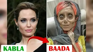 Tazama Kilichowapata Baada Ya Kumkufuru Mungu Kwa kufanya Plastic surgery 