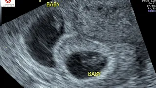 DEVASTATING NEWS ABOUT MY PREGNANCY| HOW MUCH MORE CAN WE TAKE?