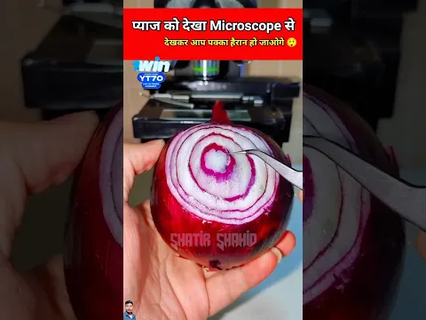 प्याज को देखा Microscope से 🧐 दुनिया भर में केवल 0.00000000001% लोग ही जानते है 😱