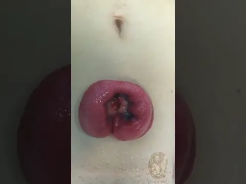 Peristaltismo GASTROINTESTINAL