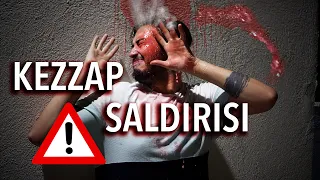 ASİT SALDIRISINDA NE YAPILMALI? | Kezzap Yarası İyileşir mi?