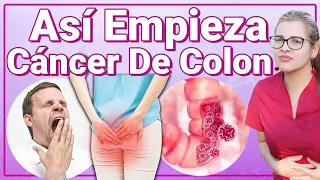 Así Empieza El Cáncer De Cólon Y No Lo Sabes - Signos Y Síntomas Que Debes Reconocer