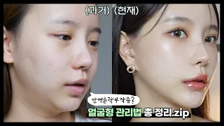 이중턱? 볼패임? 한번에 싹없애준 수술 드디어 처음으로 공개합니다 ...얼굴형 관리법 총정리!!👶✨(ENG/JPN)