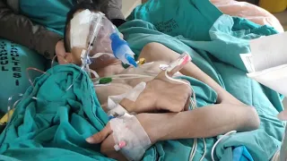 EYÜP ABİM AMELİYAT OLDU ! ( GÖZÜNDE KATARAK VARDI )