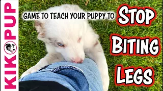 STOP biting legs - Puppy Training