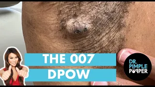The 007 DPOW