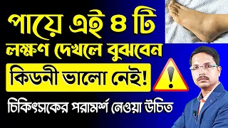 পায়ের এই ৪ টি লক্ষণ দেখলে বুঝবেন - কিডনি বিপদে আছে❗কিডনি খারাপের লক্ষণ কি❓
