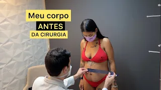 ÚLTIMA CONSULTA COM O CIRURGIÃO PLÁSTICO + meu corpo antes da cirurgia! | Loving Couple