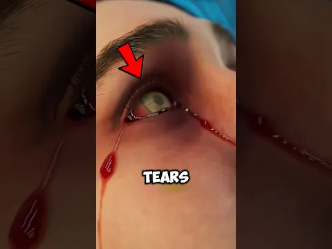 Tears Found Under the Microscope!😱