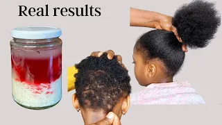No Single Hair Strand Will Fall after Using this , Speed Up Hair Growth and Reduces Hair Loss.