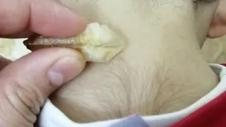 نصحتني بيها زوجه عطار ابن عطار قالي مسحه من الحجر يزيل شعر العانه والجسم كالليزر وضعتها لبناتي عجيب