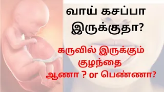 வாய் கசப்பாக இருந்தால்  என்ன குழந்தை பிறக்கும் | mettalic taste | bitter mouth | treatment