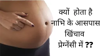 क्यों नाभि के आसपास दर्द होता है pregnancy में? stretch marks/ pain or itching around navel!!