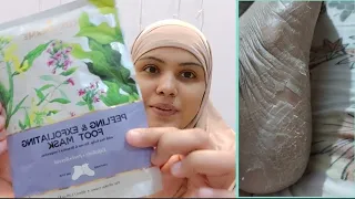 I TRIED LuxaDerme Peeling and Exfoliating Foot Mask with Sea Kelp|THE HIJABI GIRL|foot peel review
