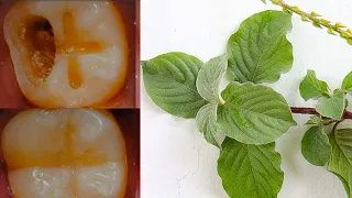 एक ही बार में दांत का कीड़ा और दर्द बाहर निकालने का अचूक देसी उपाय Remedy for Toothache Treatment