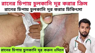 রানের চিপায় চুলকানি দূর করার ক্রিম,রানের চিপায় চুলকানি দূর করুন ৩ দিনে ! অণ্ডকোষে চুলকানীর চিকিৎসা