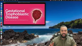 34- Gestational Trophoblastic Diseases