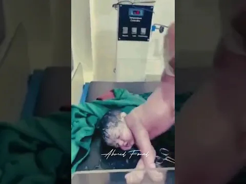 محاولة انقاذ طفل رضيع