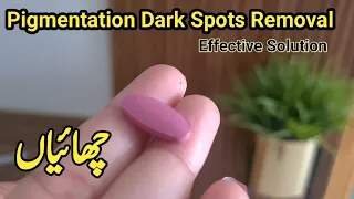 Face Pigmentation Dark Spots Removal  Effective Treatment