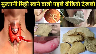मुल्तानी मिट्टी खाने के नुकसान | Side effects of eating Multani mitti in Hindi