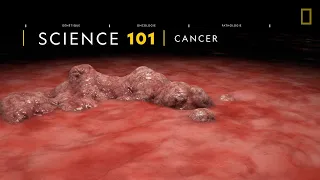 COMPRENDRE : le cancer