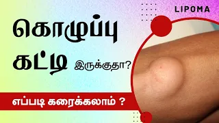 Lipoma Treatment in Tamil - Kolupu Katti கொழுப்பு கட்டி கரைய மருந்து