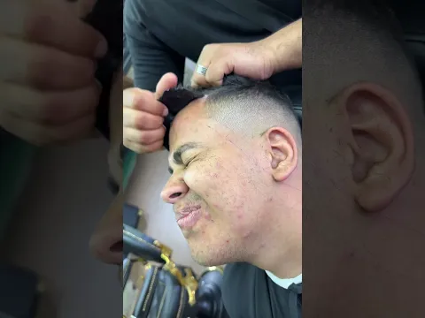ازاله شعر الجبهه بالشمع 💈✂️ #funny #اكسبلور #كوميديات #viralvideo #barber #comedymovies #foryou
