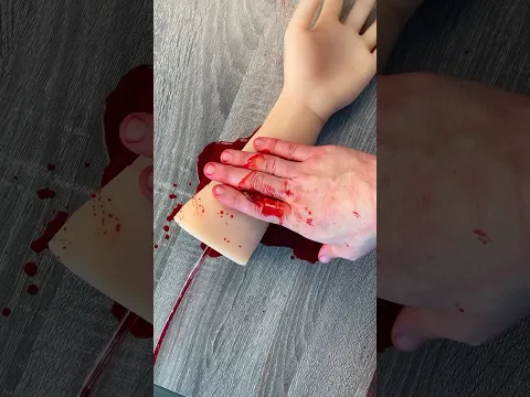 Hey, are you bleeding? Try this…