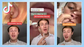 The Most Satisfying TikTok Pimple Popping Reactions Compilation!