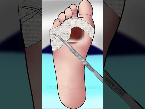 AMSR Treatment foot #asmr #animation #satisfying #trending #viral #shorts #trendingshorts