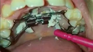 ASMR Oddly satisfying video by ASMR Videos 4U