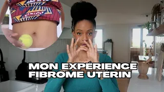 Anémie/perte cheveux/ infertilité (?) Mon expérience fibrome utérin