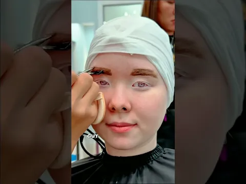 Mädchen mit Albinismus bekommt eine strahlende Verwandlung