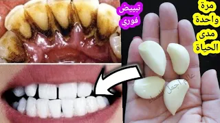 أقسم بالله لن تلجأ لطبيب الأسنان ولا لإزالة الجير سيسقط وحدة في ثواني بعد فرك أسنانك لن تصدق نتائج