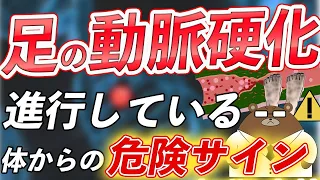 【危険】絶対に見逃してはいけない「足」の動脈硬化が進むと出現する要注意なサインとは？ASO～「閉そく性動脈硬化症」～の正体とは？