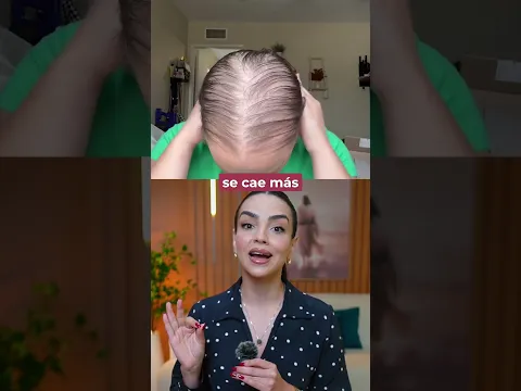 El enemigo de tu cabello esta en tu cuerpo🚨
