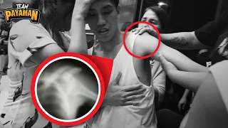 I DISLOCATED MY SHOULDER BEFORE THE YEAR ENDS