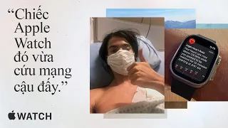 Thân gửi Apple | Apple Watch
