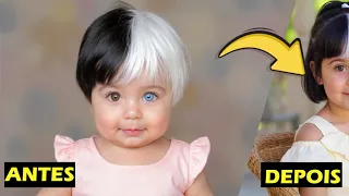 BEBÊ mais RARA do MUNDO cresceu e HOJE ela está ASSIM!