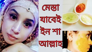 মেস্তা চিরতরে দূর করার গুরুতবপূর্ণ টিপস্ জেনে নিন | মেস্তা যাবেই ইন শা আল্লাহ | How to Remove Mesta