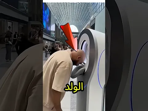 الولد حط راسه بالغلط في ماكينة قص الشعر لكن الصدمة🚨😨💥
