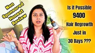 HONEST REVIEW of ThriveCo Hair Serum || FAKE or REAL??? 9400 Hair Growth IN A MONTH!!!