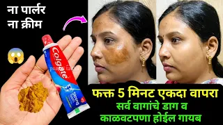 ना क्रीम ना पार्लर घरगुती पद्धतीने घालवा वांग आणि काळवटपणा 😱 kitchen tips / marathi kitchen / Tadka